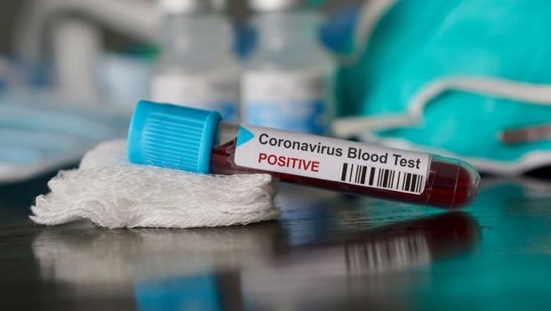 Bakıya gətirilən 29 azərbaycanlıda koronavirus aşkarlandı – RƏSMİ