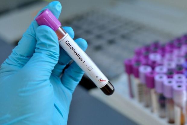 Azərbaycanda daha 40 nəfərdə koronavirus aşkarlandı – RƏSMİ