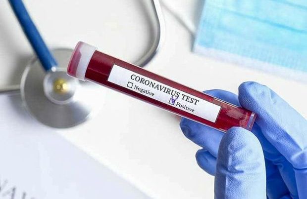 Koronavirusa yoluxanların sayı 7,5 milyonu keçdi – SON STATİSTİKA