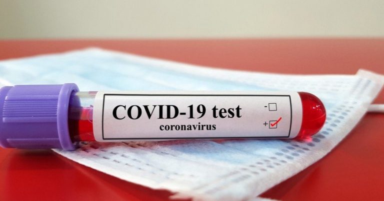 Dünyada koronavirusa yoluxanların sayı 80 milyonu ötdü
