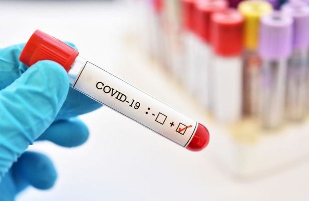 Azərbaycanda koronavirusa yoluxanların sayı açıqlandı: Onlarla ölən var – FOTO
